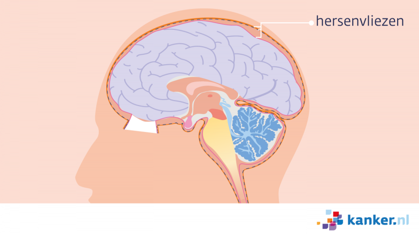 De hersenvliezen zitten rond de hersenen en het ruggenmerg, tussen de hersendelen in en aan de onderkant van de schedel.